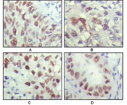 CHK2 Antibody