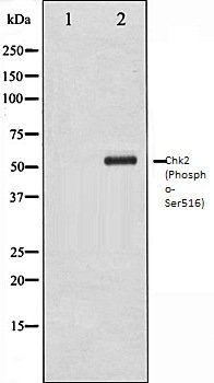 Chk2 (Phospho-Ser516) antibody
