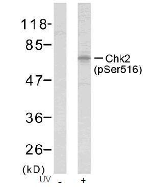 Chk2 (Phospho-Ser516) Antibody