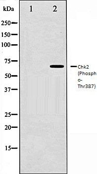 Chk2 (Phospho-Thr387) antibody
