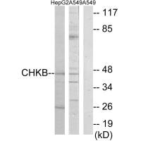 CHKB antibody
