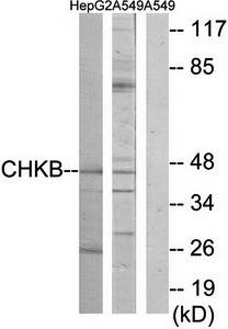 CHKB antibody