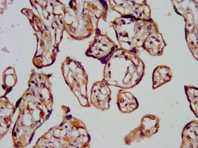 CHMP1A Antibody