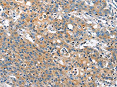 CHMP1A Antibody