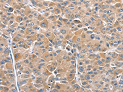 CHMP4B antibody