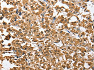 CHMP4B antibody