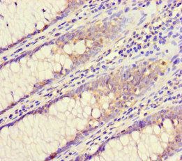 CHMP4C Antibody