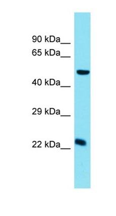 Chmp5 antibody