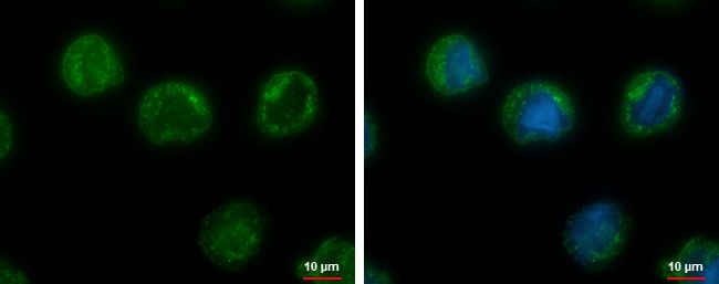 CHMP5 antibody [N1C3]