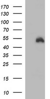 CHN 1 (CHN1) antibody