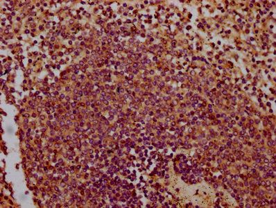 CHODL Antibody
