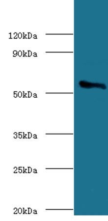 Cholesterol side-chain cleavage enzyme, mitochondrial antibody (Biotin)