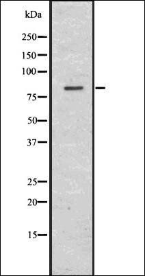 Choline Acetyltransferase antibody