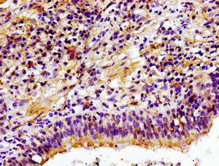CHKA Antibody