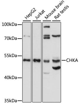 Choline kinase alpha antibody