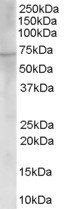 Goat anti-Choline acetyltransferase Antibody