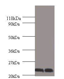 Chorionic somatomammotropin hormone antibody