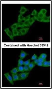 Calcium binding protein p22 antibody [N2C2], Internal