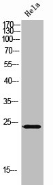 CHP1 Antibody