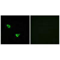 CHPF antibody