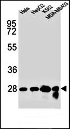 CHPT1 antibody