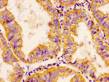 CHRDL1 antibody