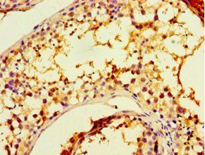 CHRFAM7A Antibody
