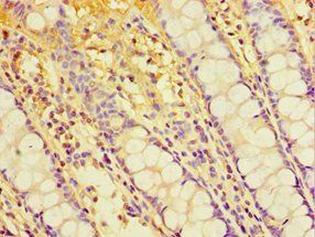 CHRFAM7A Antibody
