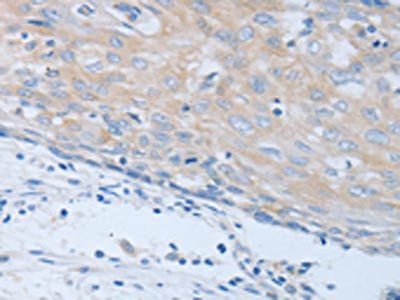 CHRNA7 Antibody