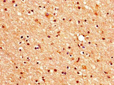 CHRM3 Antibody