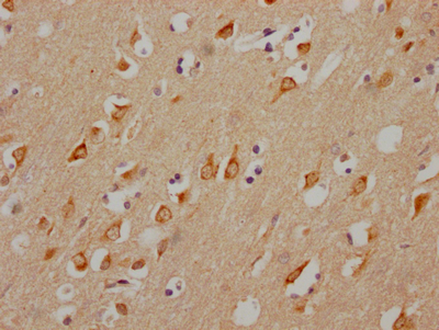 CHRM3 Recombinant Monoclonal Antibody