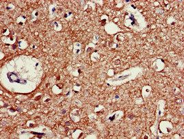 CHRM5 Antibody