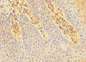 CHRNA2 antibody