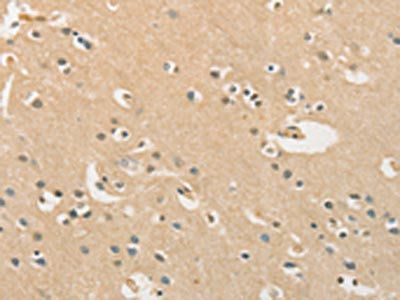 CHRNA2 Antibody