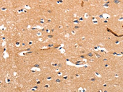 CHRNA3 Antibody