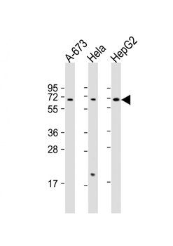 CHRNA4 antibody