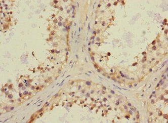 CHRNA6 antibody