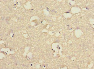 CHRNA6 Antibody