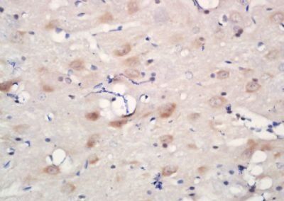CHRNA6 Rabbit Polyclonal Antibody