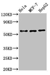 CHRNB1 antibody