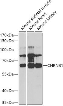 CHRNB1 antibody