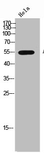 CHRNB1 antibody