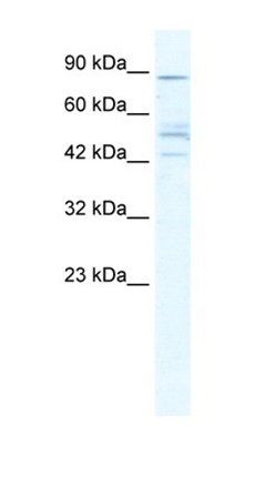 CHRNB2 antibody
