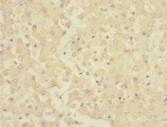 CHRNE antibody