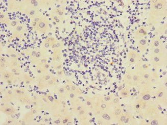 CHRNE Antibody