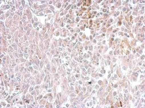 Chromogranin C antibody