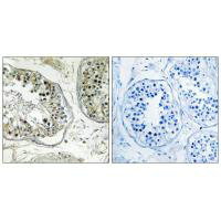 CHST13 Antibody