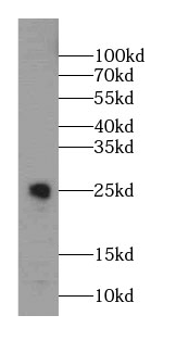 CHST13-Specific antibody