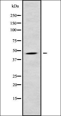 CHST14 antibody