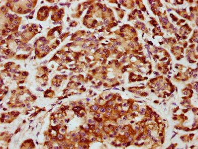 CHST14 Antibody
